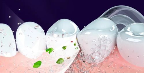 冲牙器品牌十大排名 十款高性价比必买型号详解